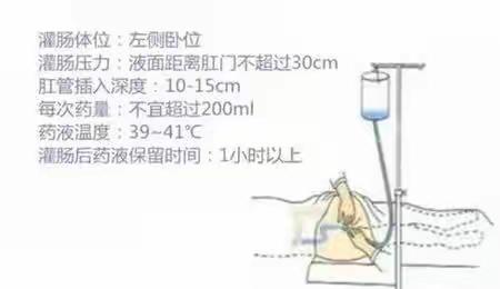 健康宣教：中药保留灌肠