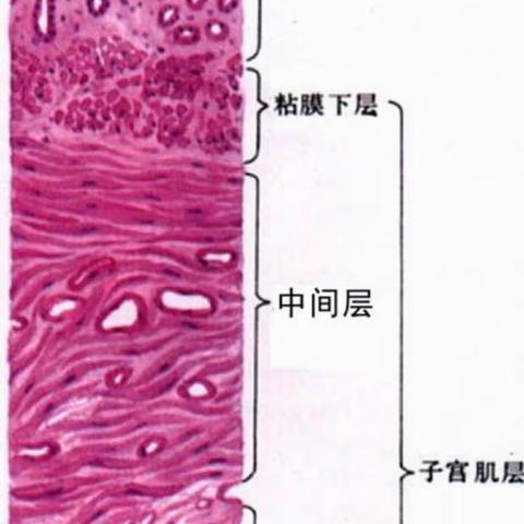 子宫肌瘤该不该“留”