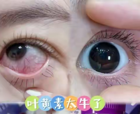 保护眼睛的叶黄素哪个牌子最好？调理近视十大品牌，央视315认证叶黄素十强