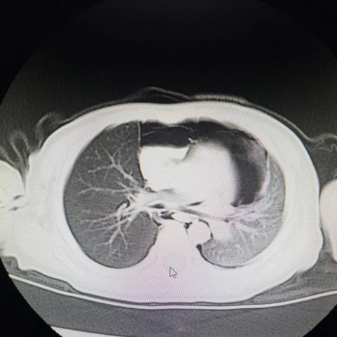 “核桃”闹元宵