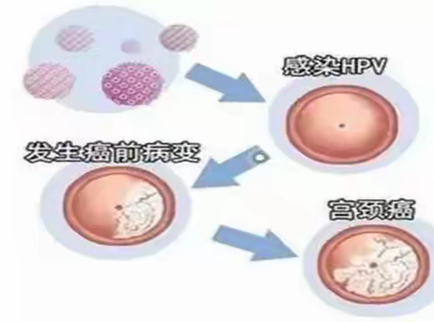 @汉正街道的女神们，这份科学防癌公式请查收！