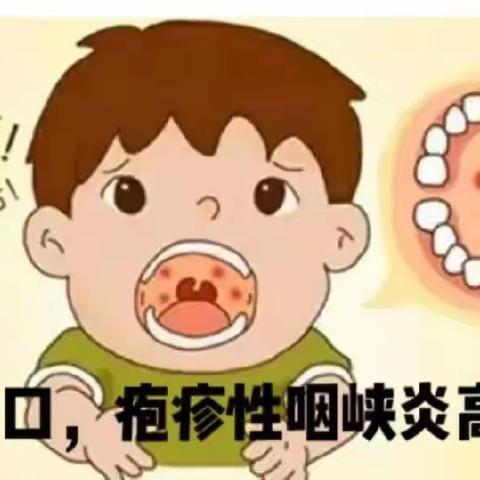 幼儿园手足口病和疱疹性咽峡炎温馨提示