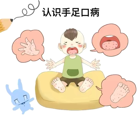 预防手足口病