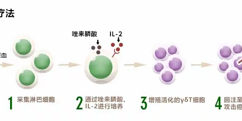 日本的γδT细胞疗法：一种新型的癌症治疗方式