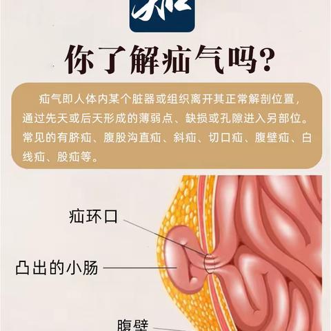 【义诊预告】龙耀医院外一科“3.7”疝气义诊活动通知