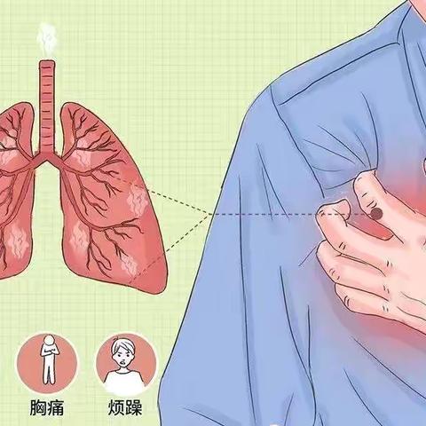 【会呼吸的痛：自发性气胸】