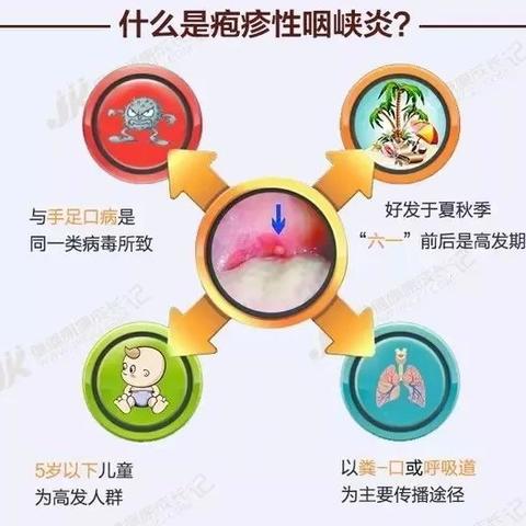 金博鑫健康科普：近期疱疹性咽峡炎流行，比手足口病还厉害！（转给家长）