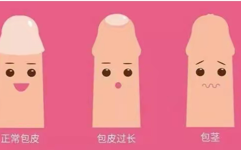 健康小知识—包皮手术要不要做