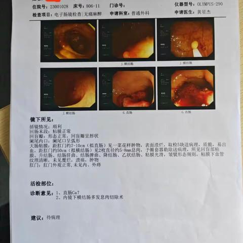 普外不普通，九旬老人直肠癌手术不是禁区