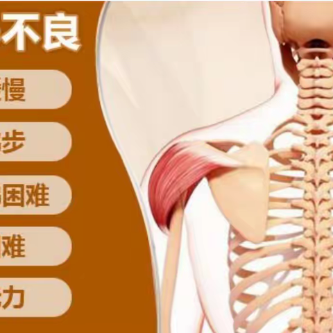 肌营养不良到底该怎么办？