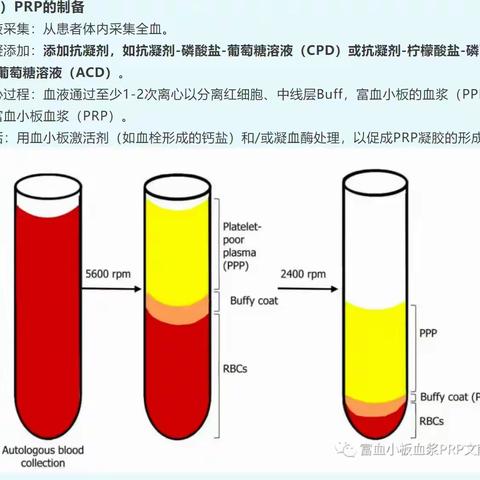 科内小讲课20240803期【炎症后色素沉着光电治疗&PRP、PRF、CGF应用相关文献分享】