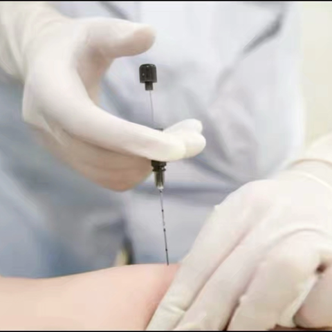 穴位埋线巧调理，中医智慧护安康——城镇分院中医科特色治疗重磅来袭