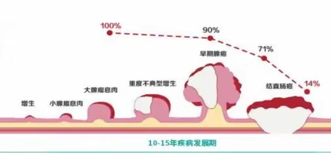 结直肠癌基础知识问答