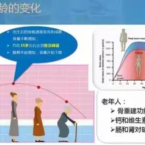 海燕谈骨质疏松第1271讲-⚡️只是轻轻摔了一下，怎么就“空”了？警惕！这种腰背痛其实是骨折！