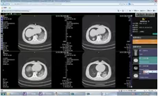 江丹、孟繁毅《新冠长期病症的中医诊治》连载 （3章-1、2节）