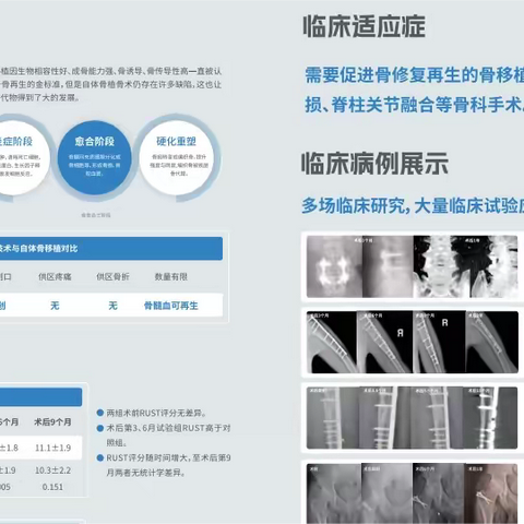 贺兰县人民医院骨科—再生技术应用，迈向崭新征程