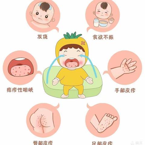 爱润幼儿园《认识手足口病、 预防手足口病》宣传小知识