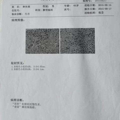 我与父亲的抗癌故事