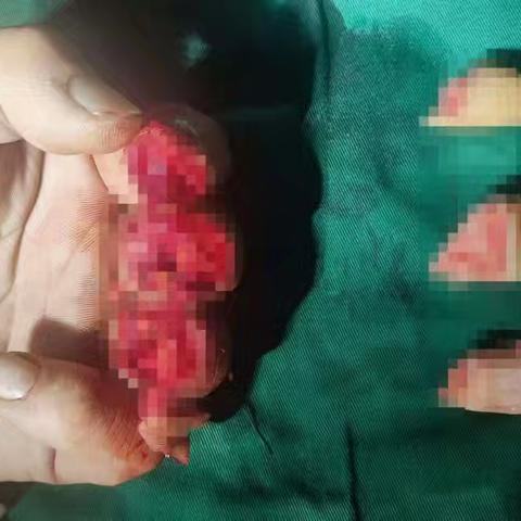 守护生命的指尖力量：医护人员敬业风采纪实