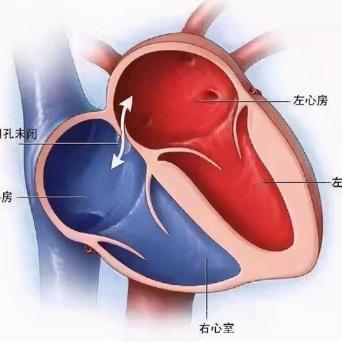 【一医•医者红】右心声学造影——“小气泡，大作用”