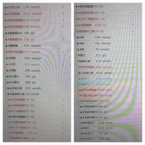 四肢无力，原来是甲减惹得祸
