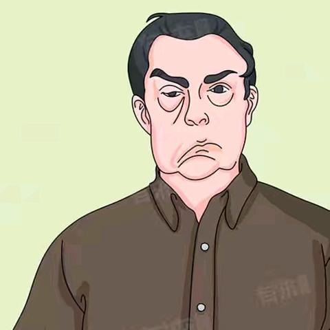 双侧面瘫？警惕格林巴利综合征
