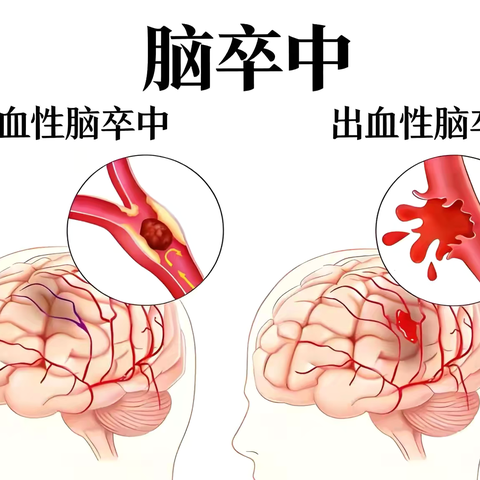 神经内科是“神经病”科吗？神经内科到底看什么病？