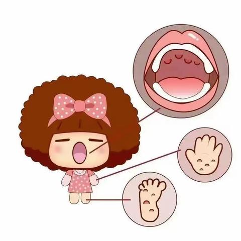 【卫生保健】家园共携手 预防手足口——西安经开白桦林居幼儿园预防手足口病科普宣传