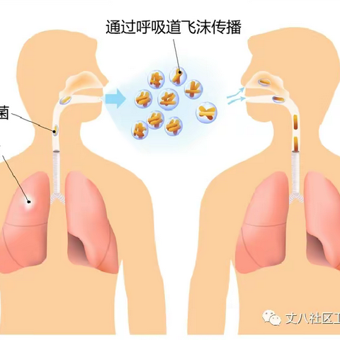 结核病防与治——宜卡、微卡