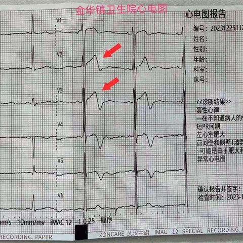 “及时识别救治、为生命保驾护航”——金华镇卫生院胸痛救治单元早期成功识别救治一例少见高危胸痛患者