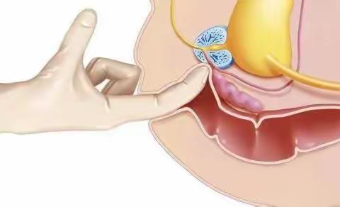 男人前列腺好不好，看内裤颜色就知道！
