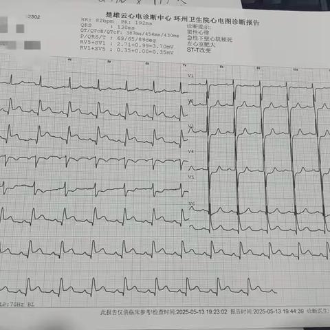 省县乡三级联动，共为生命“搭桥”