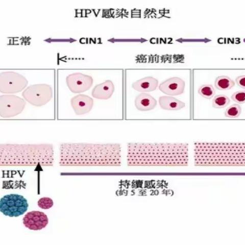 带您重新了解进口二价HPV疫苗