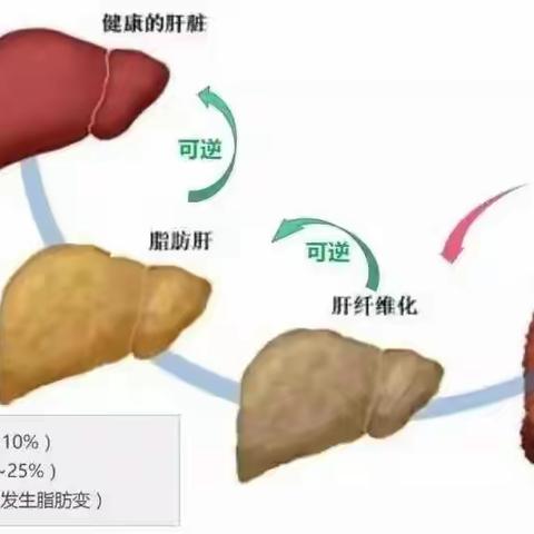 【科普】担心脂肪肝-肝纤维化？“弹一弹”就知道