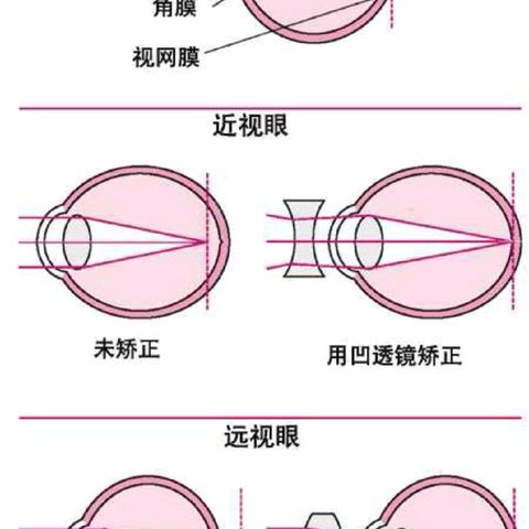 保护视力，科学护眼——开封市邢村小学防控近视知识宣传