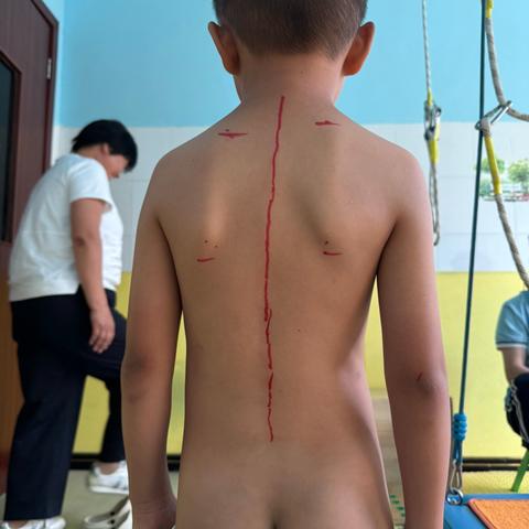 含胸驼背、高低肩 这些体态异常您家孩子有吗？