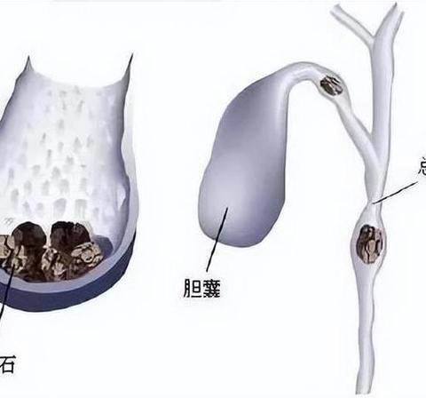 [长武华仁医院健康科普]内固定装置取除术术后有哪些并发症？