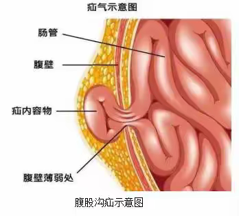 乐安三医院健康科普小常识