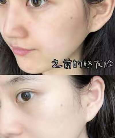 坚持喝胶原蛋白肽有好处吗