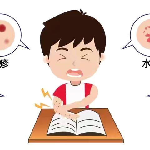 预防为主，健康无“痘” ‍定城镇大苹果幼儿园 ‍预防水痘健康知识宣传 ‍