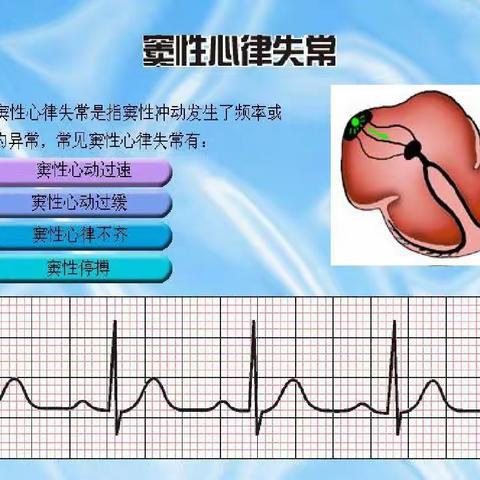 什么是心律失常？