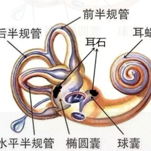 耳石症：当头晕变成了"天旋地转"