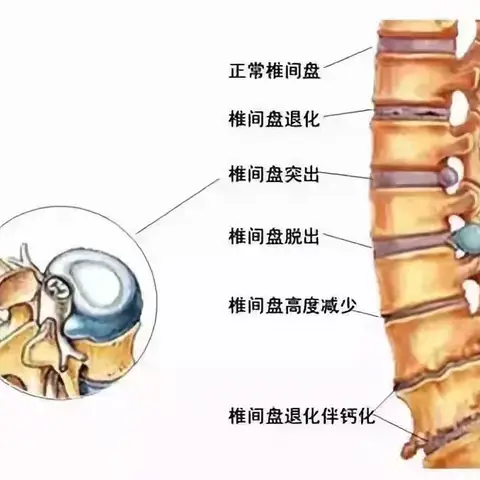 健康小知识 生活大智慧