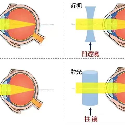 “睛”彩未来 你我“瞳”行——周陂镇中心幼儿园开展视力筛查活动