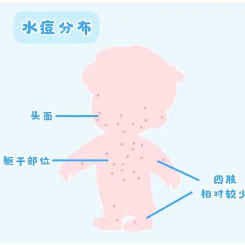 水痘防治，预防为主—智慧树幼儿园预防水痘知识宣传