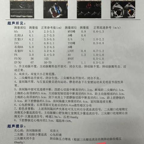 南漳县人民医院成功完成了第一例房间隔缺损介入封堵术。