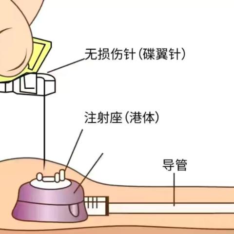 【特色护理专科门诊】--“静”心护理，“脉”向健康