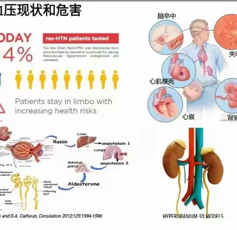 高血压五项检测：守护您的血管健康