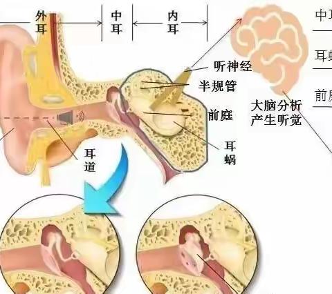 【卫生保健】爱耳护耳 聆听美好——河西幼儿园爱耳护耳知识宣传