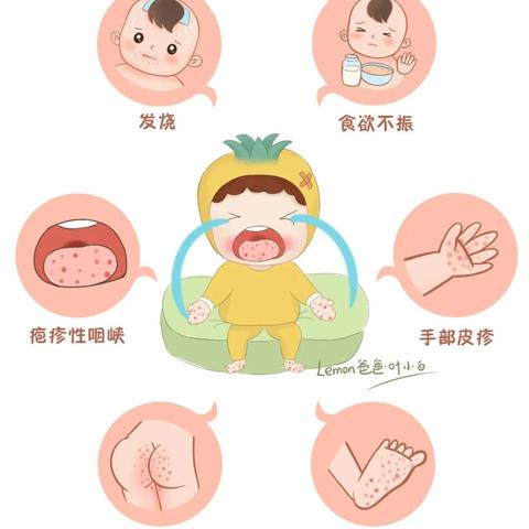 【夏季保健】乐和幼儿园夏季传染病预防知识，请家长们查收！